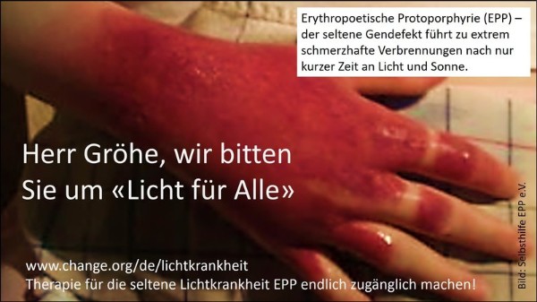Neuigkeiten zur Petition Herr Gröhe, wir bitten Sie um“Licht für Alle“