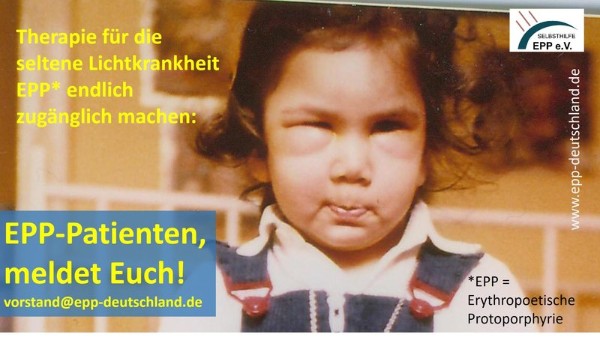 Neuigkeiten zur Petition EPP-Patienten, meldet Euch! Wer hat die #Lichtkrankheit EPP und keinen Zugang zur Behandlung?
